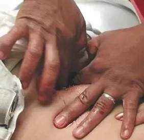 Операция хилера